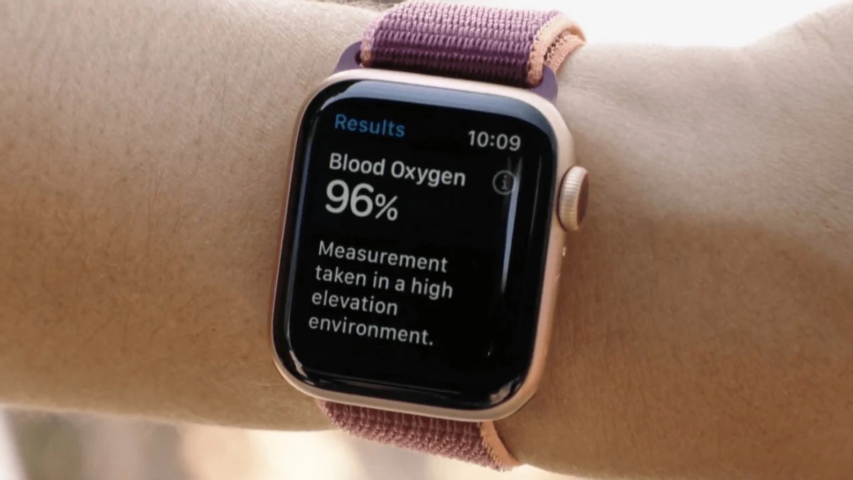 Apple выплатит Masimo 634 миллиона долларов по патентному делу Apple выплатит Masimo 634 миллиона долларов по патентному делу